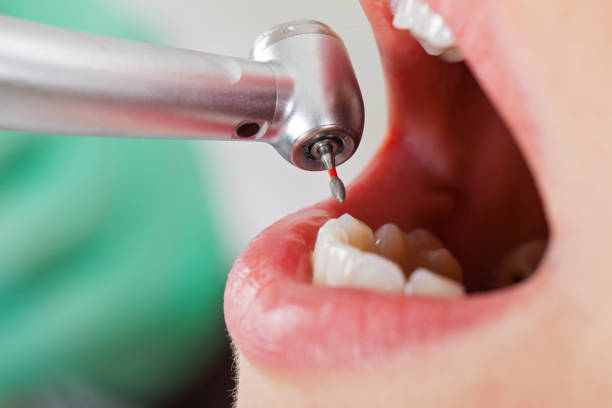Best Knocked-Out Tooth Emergency  in Rushford, MN